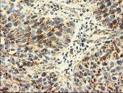 AK3 Monoclonal Antibody (OTI6B7), TrueMAB , OriGene 100 &mu;L; Unconjugated:Antibodies,