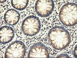 AK3 Monoclonal Antibody (OTI6B7), TrueMAB , OriGene 100 &mu;L; Unconjugated:Antibodies,
