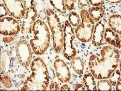 AK3 Mouse anti-Human, Clone: OTI4C4, lyophilized, TrueMAB 100 &mu;g; Unconjugated:Antibodies,