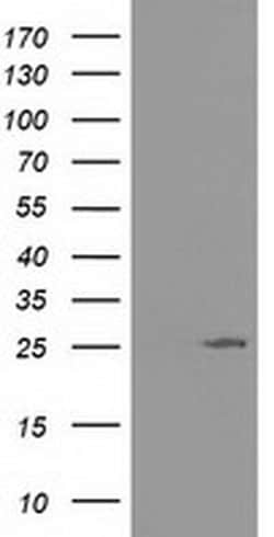 AK3 Monoclonal Antibody (OTI6D6), TrueMAB , OriGene 100 &mu;L | Buy Online | Origene Technologies | Fisher Scientific