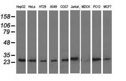 AK3 Monoclonal Antibody (OTI6D6), TrueMAB , OriGene 100 &mu;L | Buy Online | Origene Technologies | Fisher Scientific