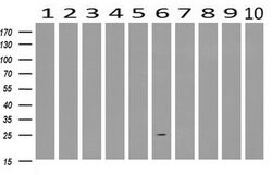 AK3 Mouse anti-Canine, Human, Rat, Clone: OTI6D6, lyophilized, TrueMAB
