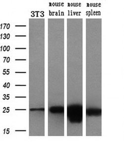 AK3 Monoclonal Antibody (OTI6D6), TrueMAB , OriGene 100 &mu;L | Buy Online | Origene Technologies | Fisher Scientific