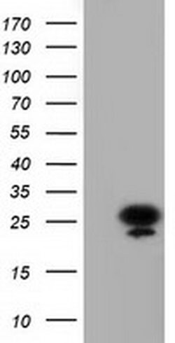 AK3 Monoclonal Antibody (OTI6B7), TrueMAB , OriGene 100 &mu;L; Unconjugated:Antibodies,
