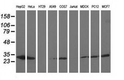 AK3 Monoclonal Antibody (OTI6B7), TrueMAB , OriGene 100 &mu;L; Unconjugated:Antibodies,