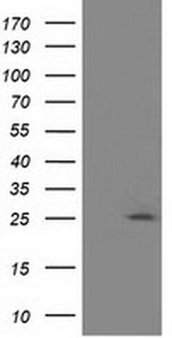 AK3 Monoclonal Antibody (OTI4A2), TrueMAB , OriGene:Antibodies:Primary