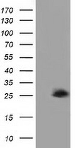 AK3 Mouse anti-Human, Clone: OTI4C4, liquid, TrueMAB 100 &mu;L; Unconjugated:Antibodies,