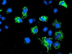 AK4 Monoclonal Antibody (OTI5E7), TrueMAB , OriGene 100 &mu;L; Unconjugated:Antibodies,