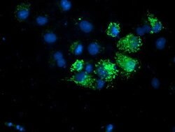 AK4 Mouse anti-Human, Clone: OTI7E5, lyophilized, TrueMAB 100 &mu;g; Unconjugated:Antibodies,