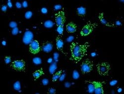 AK4 Monoclonal Antibody (OTI1H1), TrueMAB , OriGene 100 &mu;L; Unconjugated:Antibodies,