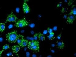 AK4 Monoclonal Antibody (OTI2D1), TrueMAB , OriGene:Antibodies:Primary