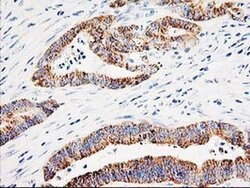 AK4 Monoclonal Antibody (OTI5E7), TrueMAB , OriGene:Antibodies:Primary