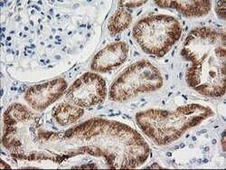 AK4 Monoclonal Antibody (OTI5E7), TrueMAB , OriGene 100 &mu;L; Unconjugated:Antibodies,