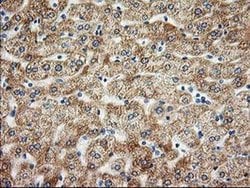 AK4 Monoclonal Antibody (OTI5E7), TrueMAB , OriGene 100 &mu;L; Unconjugated:Antibodies,