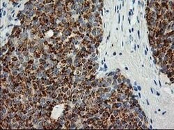 AK4 Monoclonal Antibody (OTI5E7), TrueMAB , OriGene 100 &mu;L; Unconjugated:Antibodies,