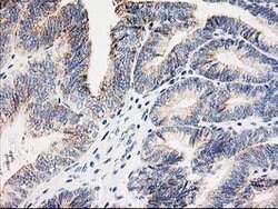 AK4 Mouse anti-Canine, Human, Mouse, Rat, Clone: OTI3B1, lyophilized, TrueMAB
