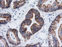 AK4 Mouse anti-Canine, Human, Mouse, Rat, Clone: OTI3B1, lyophilized, TrueMAB