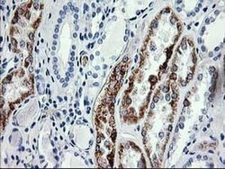 AK4 Monoclonal Antibody (OTI1H1), TrueMAB , OriGene 100 &mu;L; Unconjugated:Antibodies,