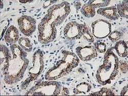 AK4 Mouse anti-Canine, Human, Clone: OTI2B12, lyophilized, TrueMAB 100