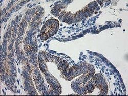 AK4 Monoclonal Antibody (OTI2D1), TrueMAB , OriGene 100 &mu;L; Unconjugated:Antibodies,