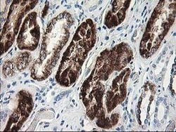 AK4 Monoclonal Antibody (OTI2D1), TrueMAB , OriGene 100 &mu;L; Unconjugated:Antibodies,