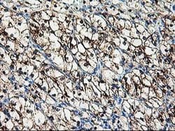 AK4 Monoclonal Antibody (OTI2D1), TrueMAB , OriGene 100 &mu;L; Unconjugated:Antibodies,