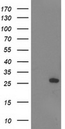 AK4 Monoclonal Antibody (OTI5B10), TrueMAB , OriGene 100 &mu;L; Unconjugated:Antibodies,