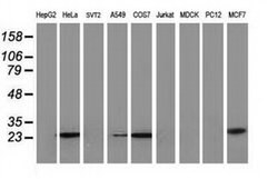 AK4 Monoclonal Antibody (OTI3E1), TrueMAB , OriGene 30 &mu;L; Unconjugated:Anticuerpos