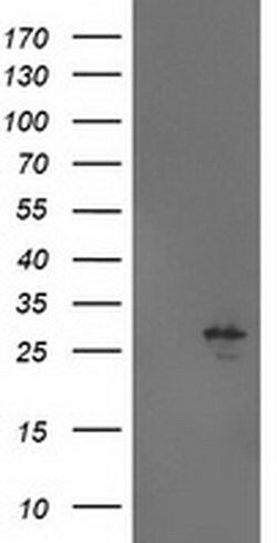 AK4 Monoclonal Antibody (OTI5E7), TrueMAB , OriGene 100 &mu;L; Unconjugated:Antibodies,