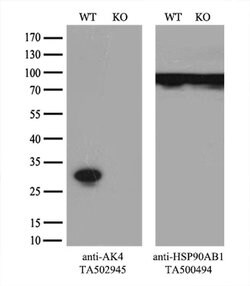 AK4 Monoclonal Antibody (OTI5E7), TrueMAB , OriGene 100 &mu;L; Unconjugated:Antibodies,
