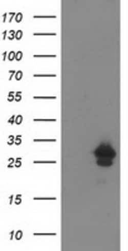 AK4 Mouse anti-Human, Clone: OTI7E5, lyophilized, TrueMAB 100 &mu;g; Unconjugated:Antibodies,