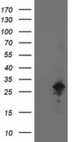 AK4 Mouse anti-Canine, Human, Mouse, Rat, Clone: OTI3B1, lyophilized, TrueMAB