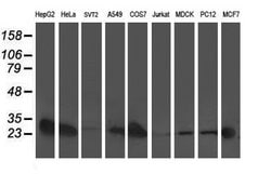 AK4 Mouse anti-Canine, Human, Mouse, Rat, Clone: OTI3B1, lyophilized, TrueMAB