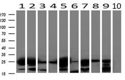 AK4 Mouse anti-Canine, Human, Mouse, Rat, Clone: OTI3B1, lyophilized, TrueMAB