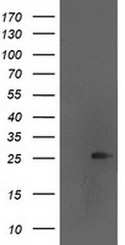 AK4 Monoclonal Antibody (OTI1H1), TrueMAB , OriGene 100 &mu;L; Unconjugated:Antibodies,