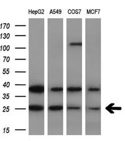 AK4 Monoclonal Antibody (OTI1H1), TrueMAB , OriGene 100 &mu;L; Unconjugated:Antibodies,