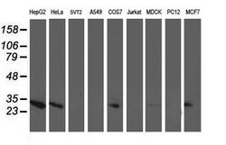 AK4 Mouse anti-Canine, Human, Clone: OTI2B12, lyophilized, TrueMAB 100