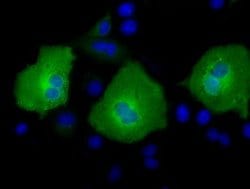 AK5 Mouse anti-Human, Clone: OTI1C5, lyophilized, TrueMAB 100 &mu;g; Unconjugated:Antibodies,