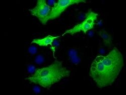AK5 Monoclonal Antibody (OTI1D6), TrueMAB , OriGene 100 &mu;L; Unconjugated:Antibodies,