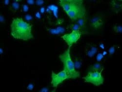 AK5 Monoclonal Antibody (OTI2D3), TrueMAB , OriGene:Antibodies:Primary