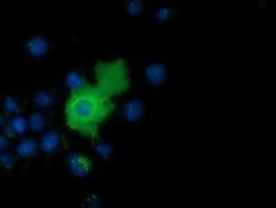 AK5 Monoclonal Antibody (OTI2F9), TrueMAB , OriGene 100 &mu;L; Unconjugated:Antibodies,