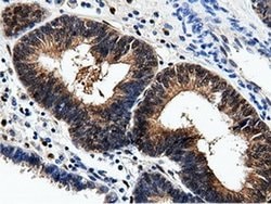 AK5 Monoclonal Antibody (OTI2A2), TrueMAB , OriGene 100 &mu;L; Unconjugated:Antibodies,