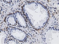 AK5 Monoclonal Antibody (OTI2A2), TrueMAB , OriGene 100 &mu;L; Unconjugated:Antibodies,