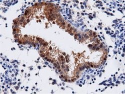AK5 Monoclonal Antibody (OTI2A2), TrueMAB , OriGene 100 &mu;L; Unconjugated:Antibodies,