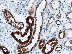 AK5 Monoclonal Antibody (OTI2A2), TrueMAB , OriGene 100 &mu;L; Unconjugated:Antibodies,