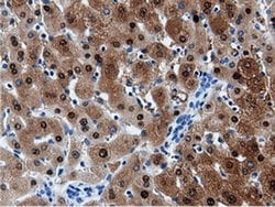 AK5 Monoclonal Antibody (OTI2A2), TrueMAB , OriGene 100 &mu;L; Unconjugated:Antibodies,