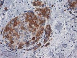AK5 Mouse anti-Human, Clone: OTI1G3, lyophilized, TrueMAB 100 &mu;g; Unconjugated:Antibodies,