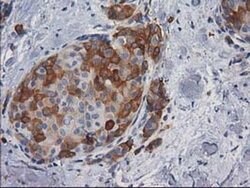 AK5 Monoclonal Antibody (OTI1G3), TrueMAB , OriGene:Antibodies:Primary