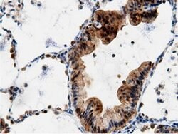 AK5 Monoclonal Antibody (OTI2F9), TrueMAB , OriGene 100 &mu;L; Unconjugated:Antibodies,