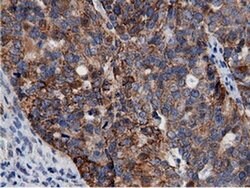 AK5 Monoclonal Antibody (OTI2F9), TrueMAB , OriGene 100 &mu;L; Unconjugated:Antibodies,